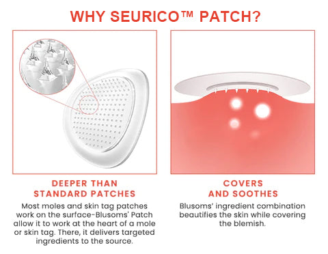 Seurico™ MicroDarts TAG'Gone Patch